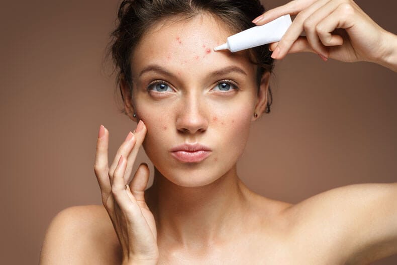 Natural Acne Treatments