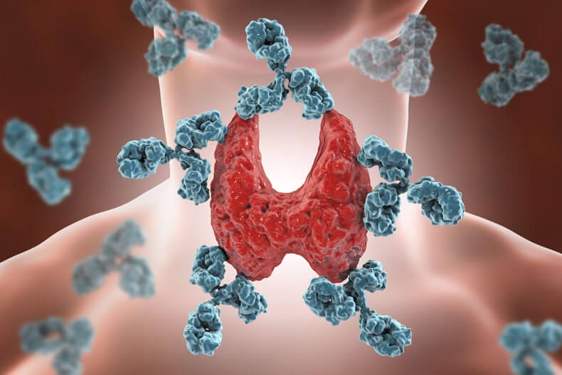 Autoimmune Disease Treatment Perth – Reversing Autoimmunity