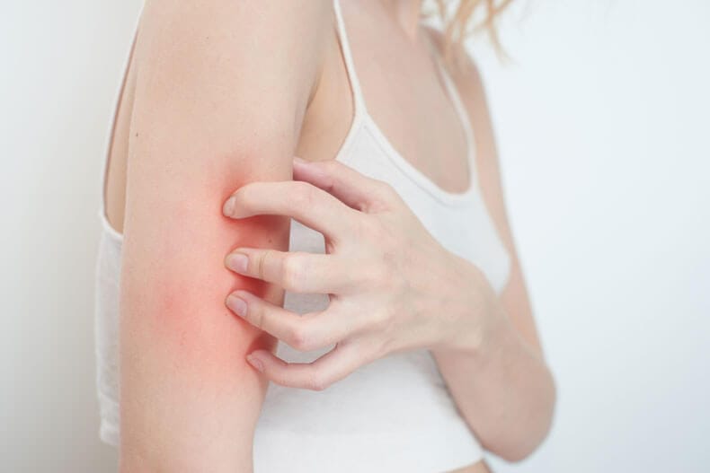 Perth holistic & natural skin treatment