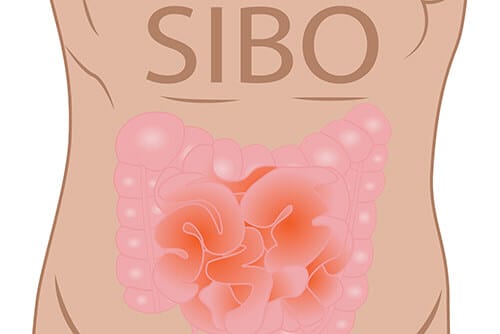 SIBO
