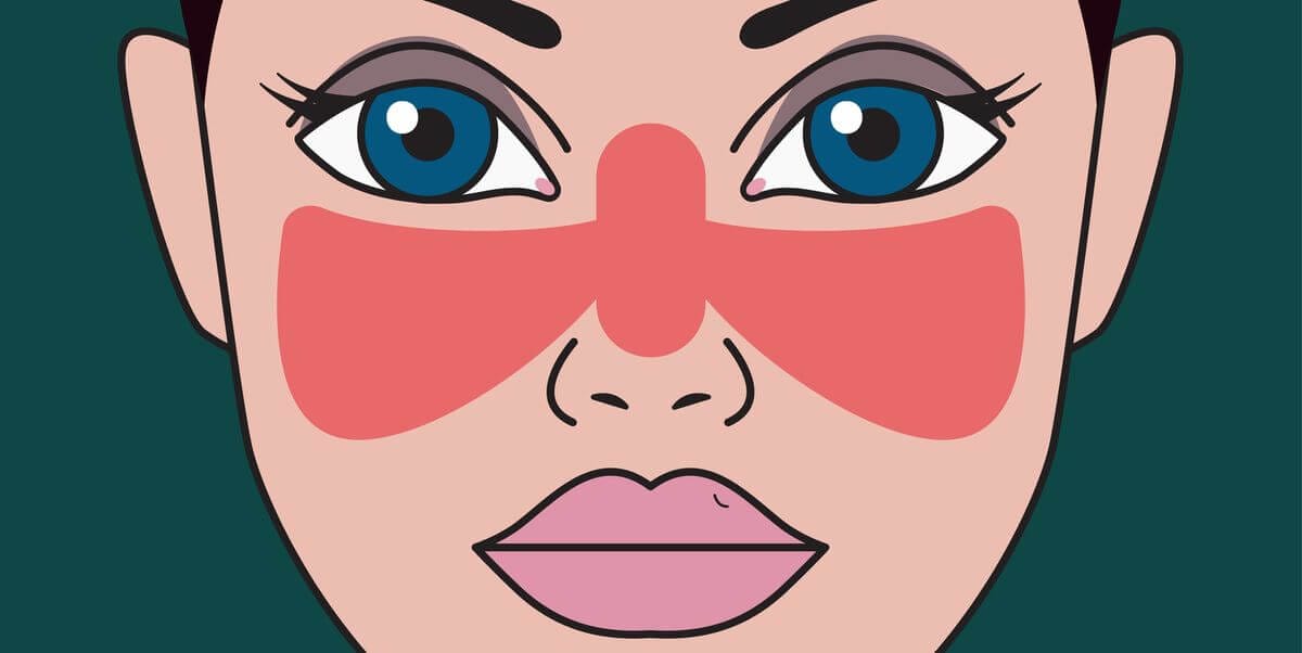 Functional medicine approach to lupus